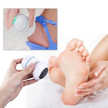 Pedi Pro - Električni odstranjivač kurjih očiju s nogu